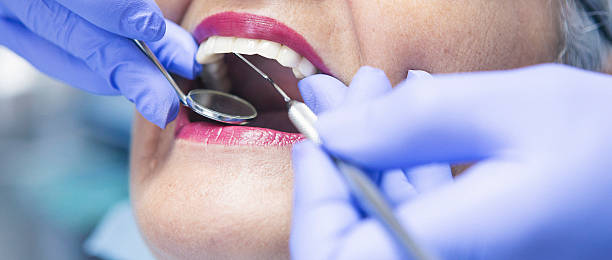Best Broken or Chipped Tooth Repair in Malabar, FL